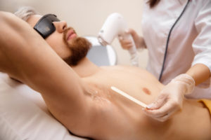 Hormones Impact Laser Hair Removal