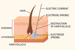 how electrolysis works