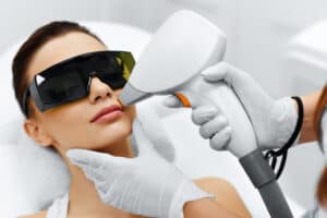 Laser Hair Removal peach fuzz