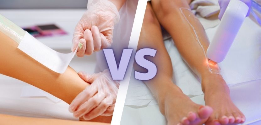 Waxing vs Laser Hair Removal