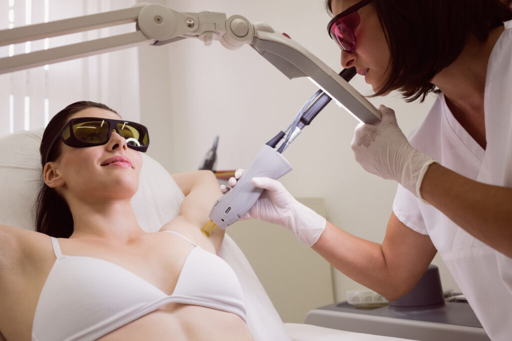 underarm laser hair removal