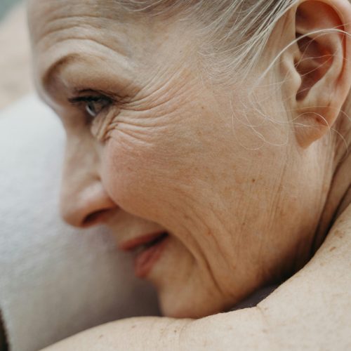 electrolysis for white hair