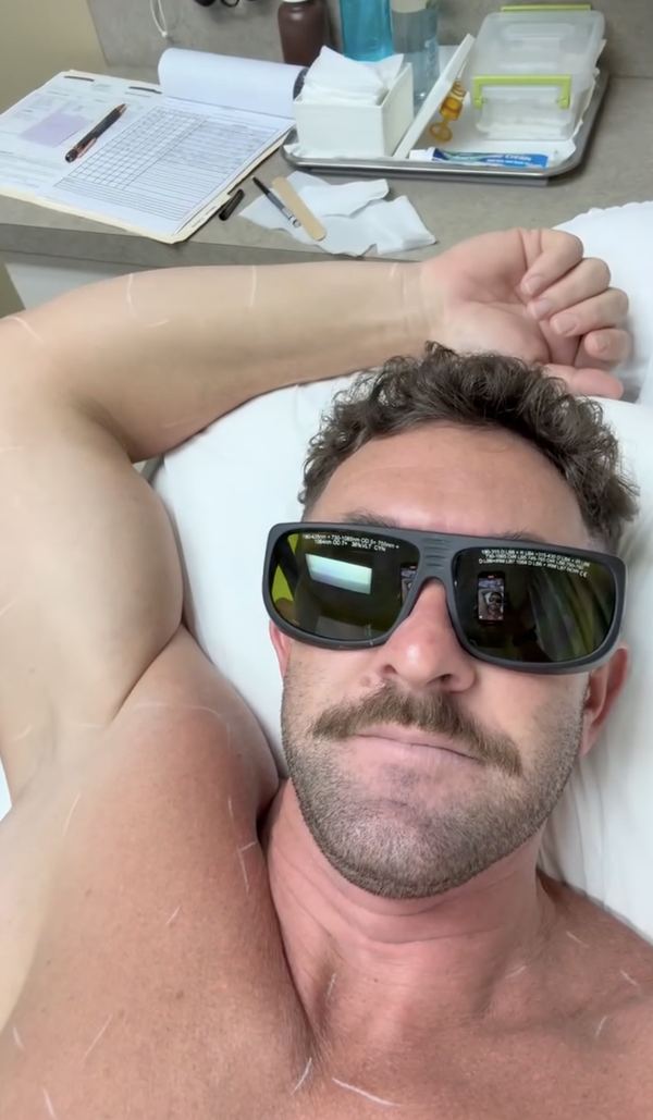 Client relaxing during a laser hair removal treatment at Laser Affair in Tampa