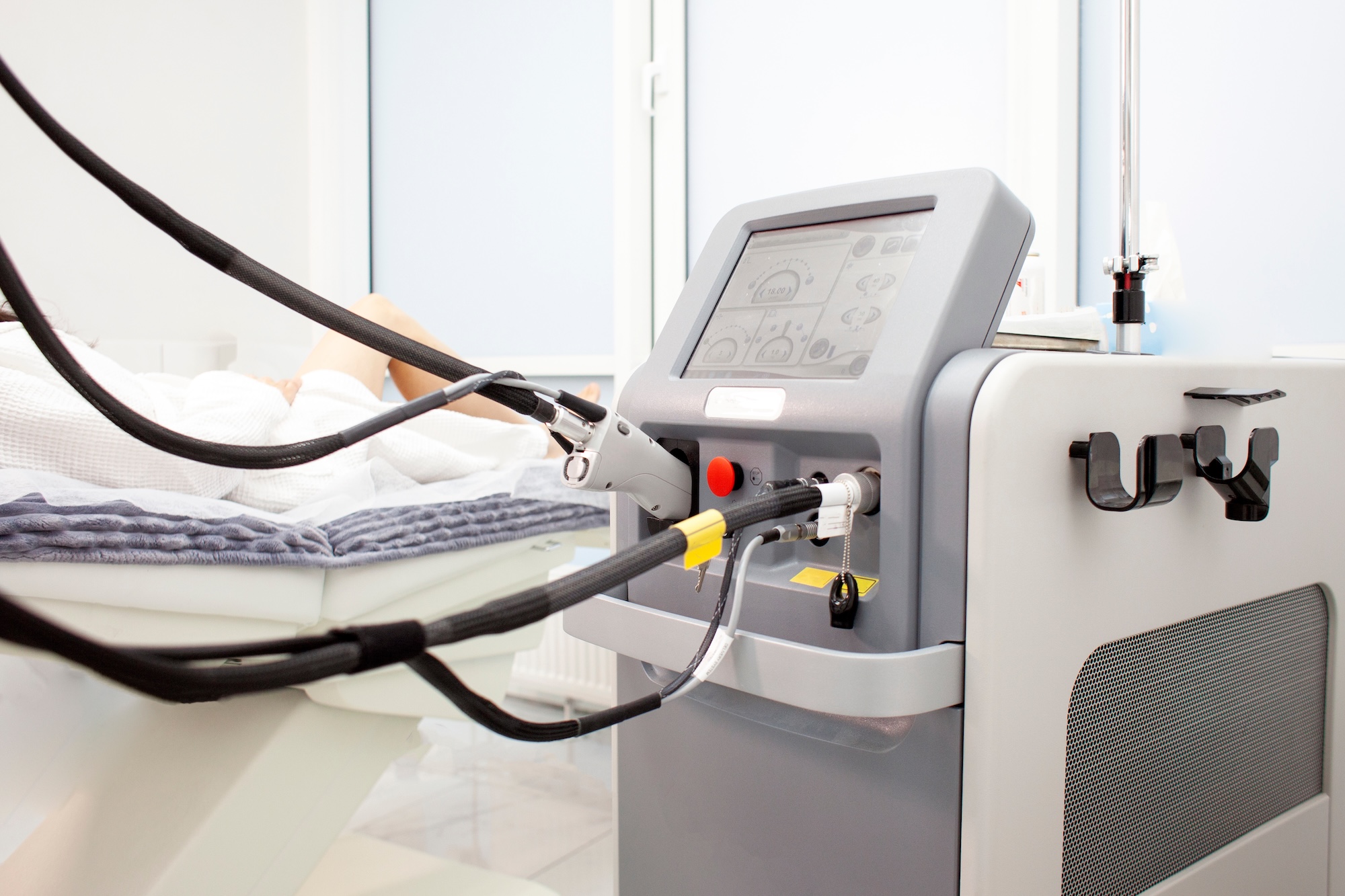 Chest laser hair removal at Laser Affair in Tampa