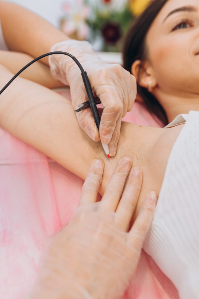 Procedure removal of hair permanently in a woman's armpits using metod electro epilation. Permanent removal of unwanted hair. The needle of electrolysis. Doctor in medical cabinet.